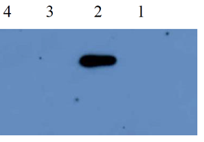 western blot using anti-PR-5 antibodies